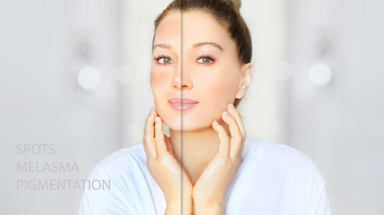 skin whitening serum